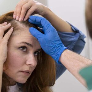 Behandling af hårtab