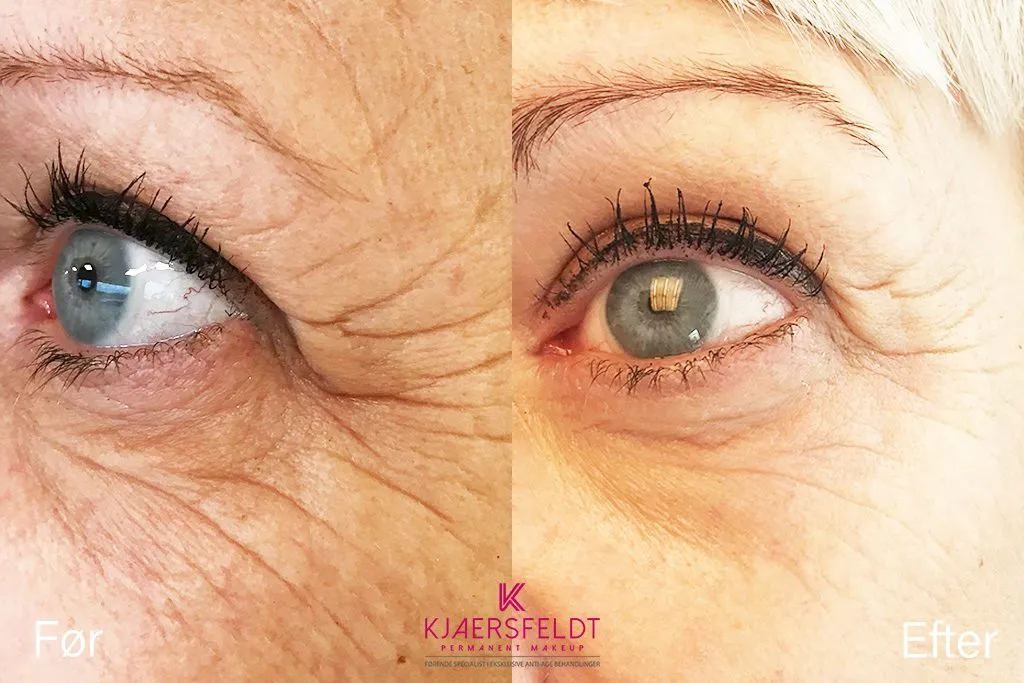 Oejenloeft-botophase-1024x683-1