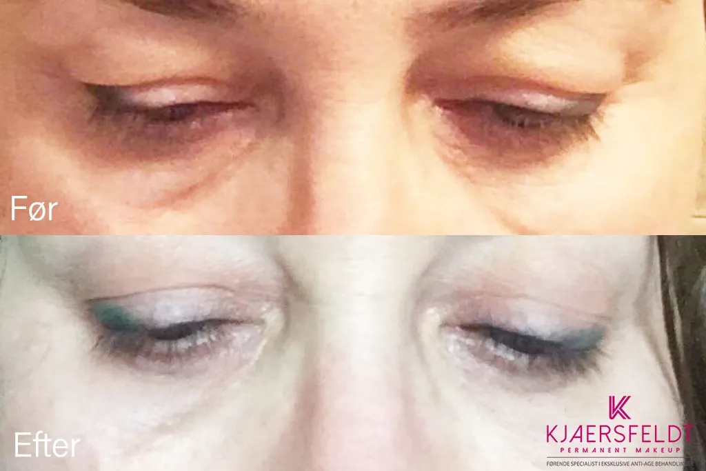 Oejenloeft-med-celluphase