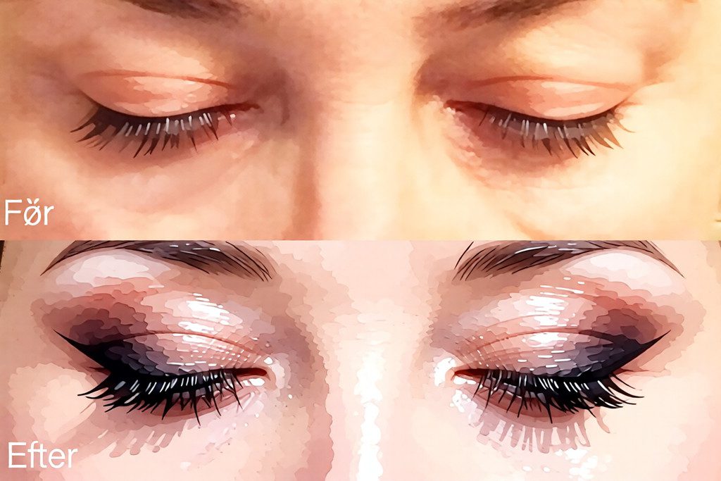 oejenloeft-uden-kirurgi