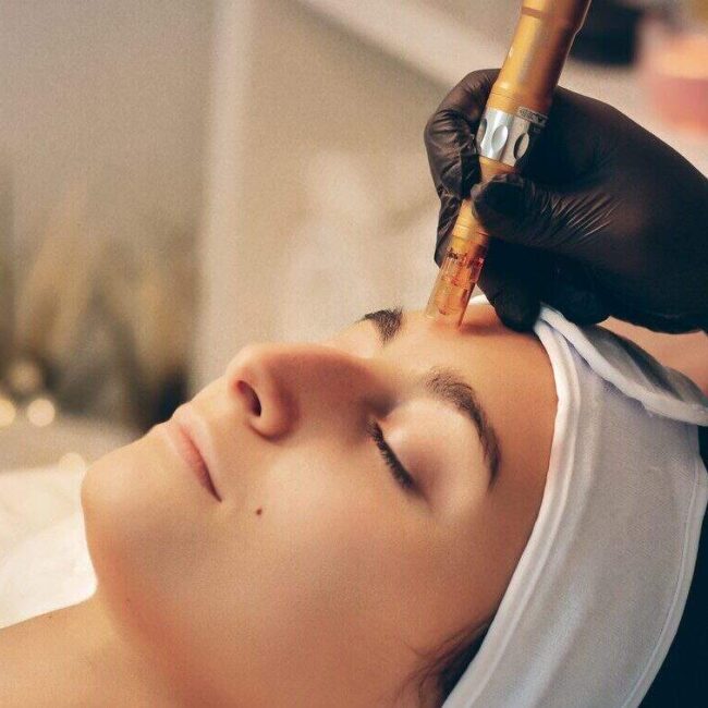 Mesoterapi og Microneedling med Mesoskinline