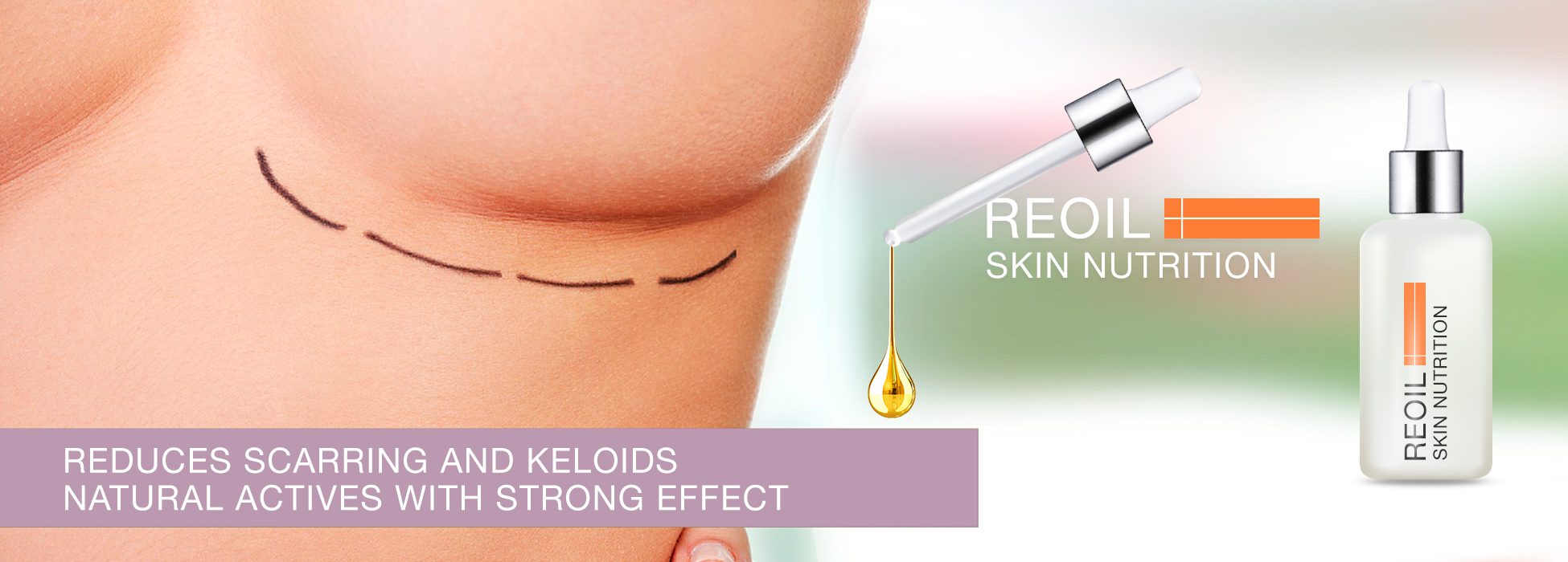 REOIL (30 mL) - Billede 4