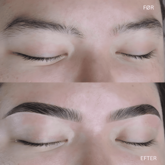 Brynlaminering før og efter – brow lift i Hvidovre
