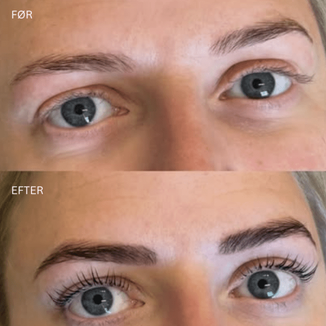 Lash lift før og efte ri Hvidovre