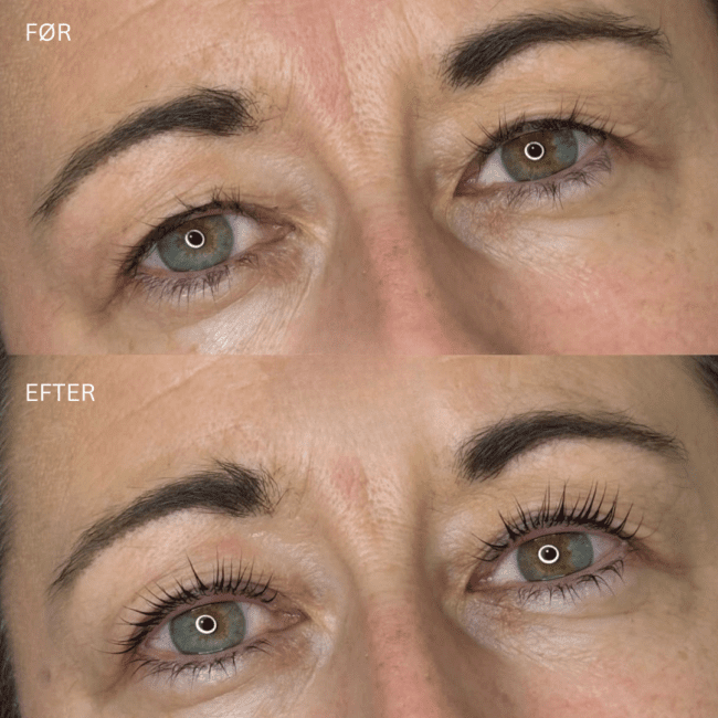 Naturlig lash lift behandling før og efter