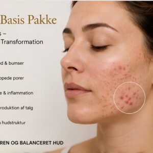Akne Basis Pakke