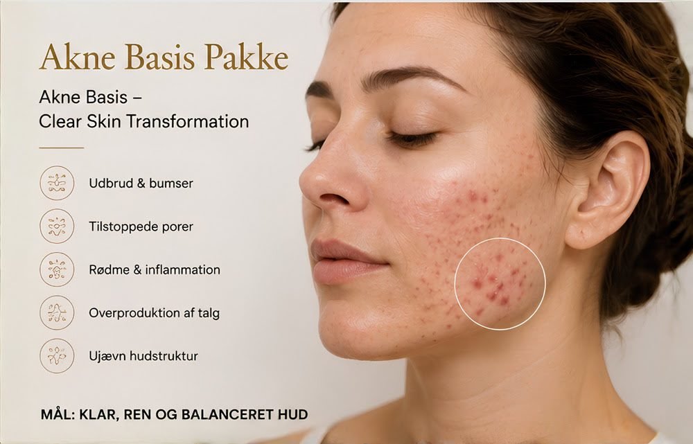 Akne Basis Pakke