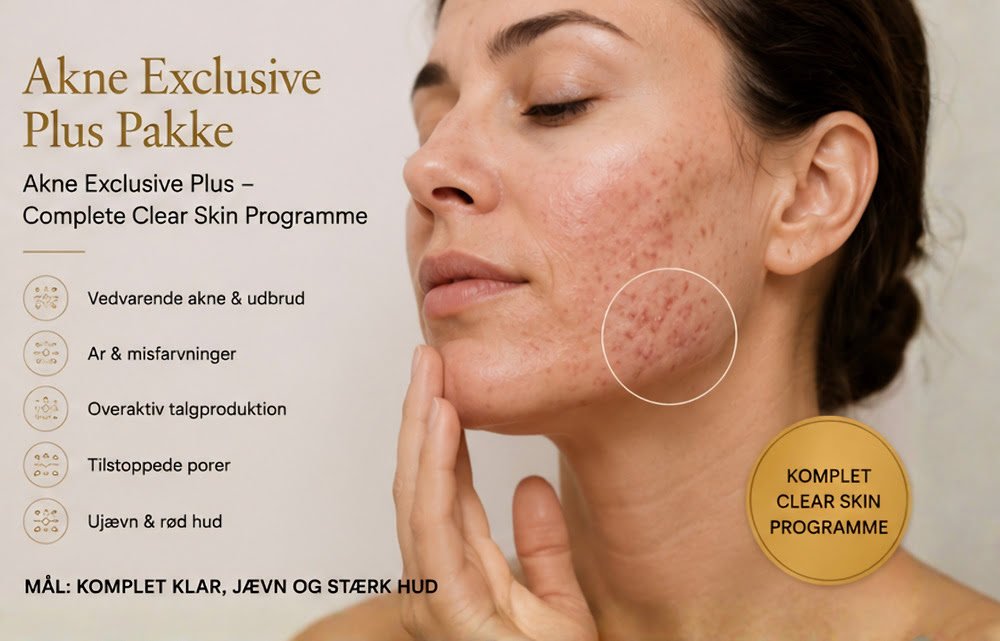 Akne Exclusive Plus Pakke